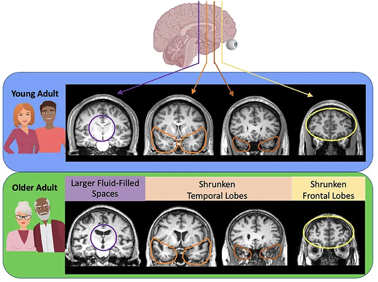 Your Brain Is Listening: The Surprising Link Between Untreated Hearing Loss and Cognitive Decline